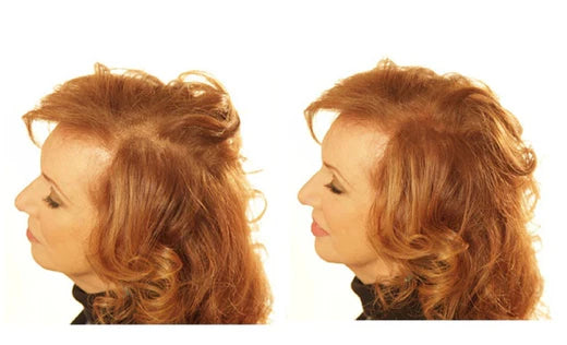 Is Hair Loss Concealer suitable for me?