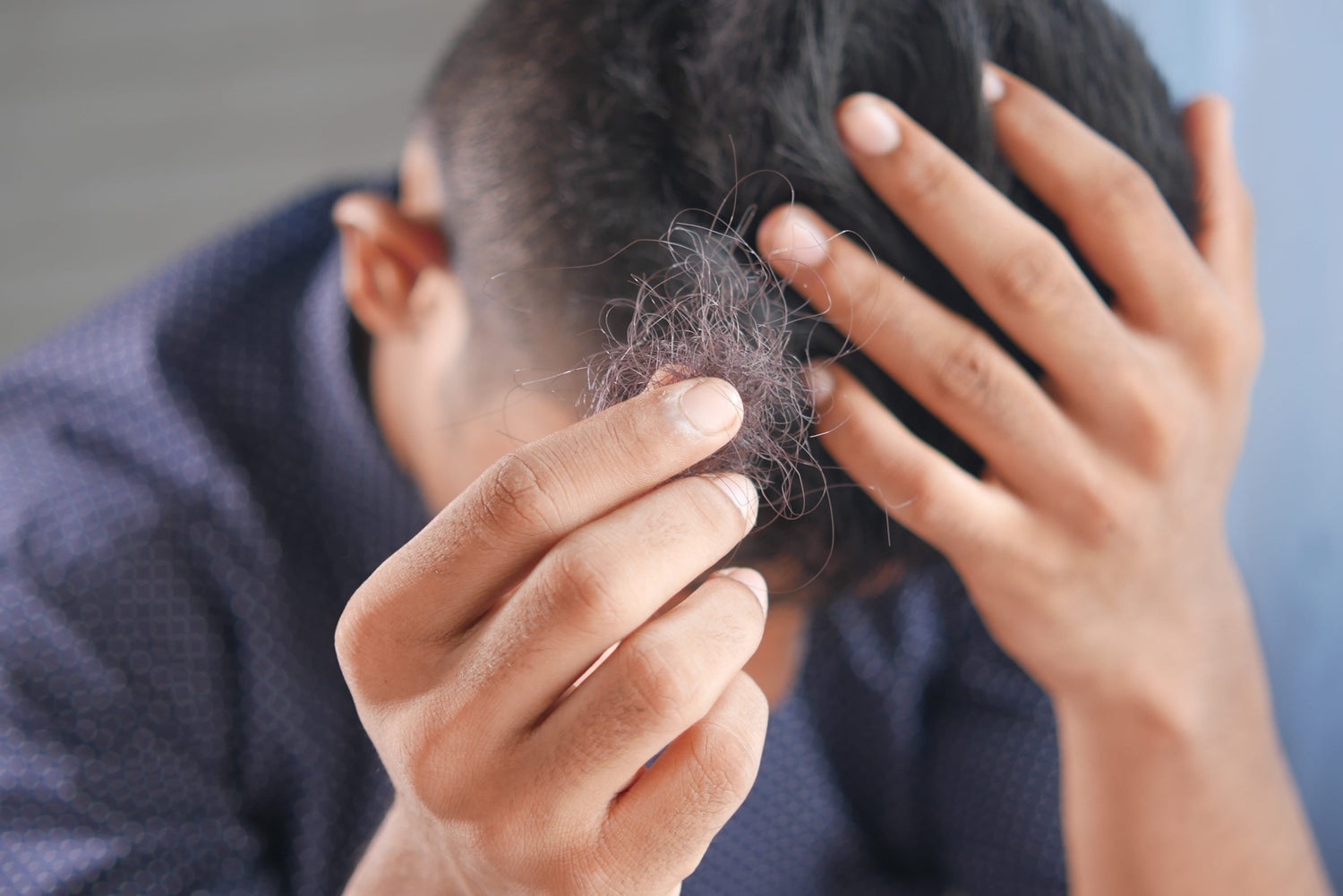 A young man bending his head and showing a fall clump of hair. Concept of hair loss.